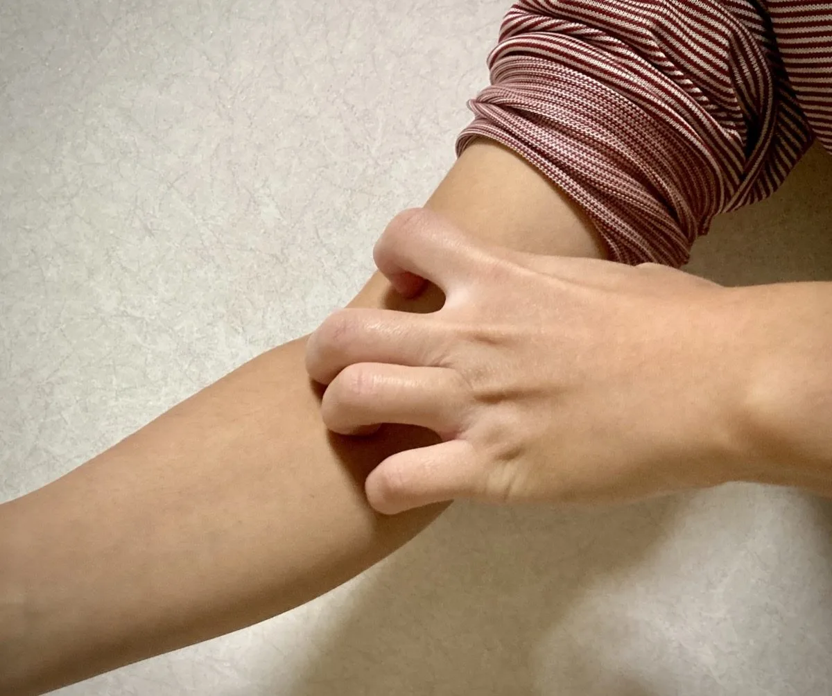 【實用對策】小心床蝨！做好這幾點，不用怕臭蟲跟回家